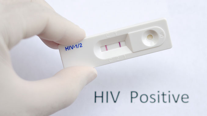 Ansatz-für-HIV-Impfung Ansatz für HIV-Impfung - © jarun011 - Fotolia