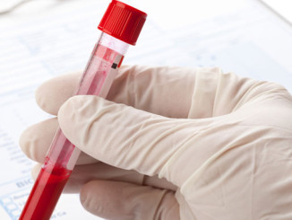 Antikörper HIV-Therapie - © Shawn Hempel - Fotolia