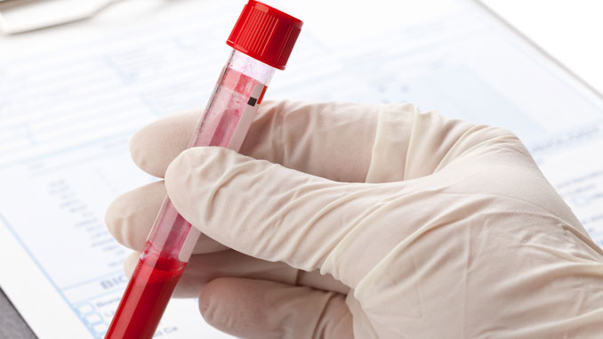 Antikoerper-HIV-Therapie Antikörper HIV-Therapie - © Shawn Hempel - Fotolia